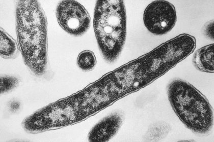 V hotelovej virivke v Demanovskej Doline nasli bakteriu Legionella