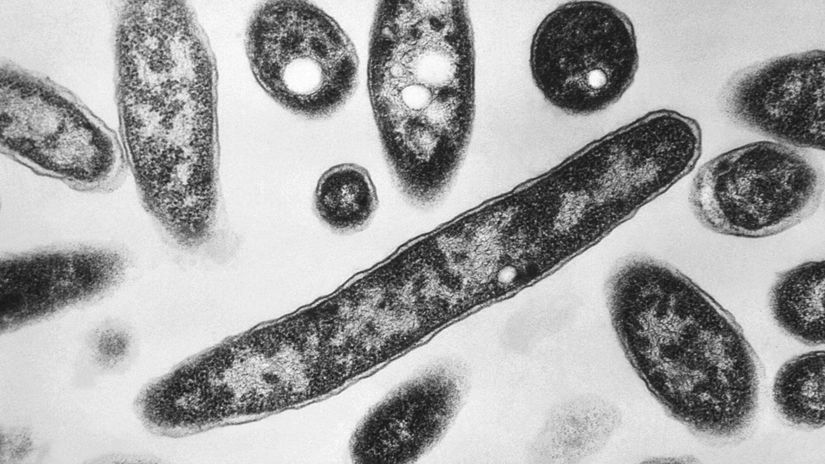 V hotelovej virivke v Demanovskej Doline nasli bakteriu Legionella
