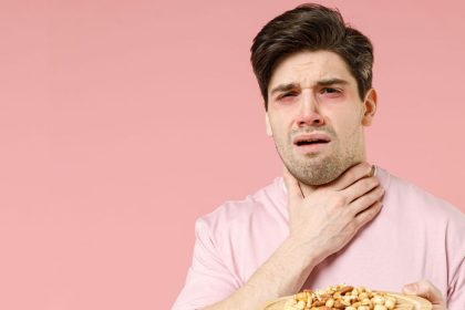 KVIZ Potravinove alergie a intolerancie rozlisujes ich