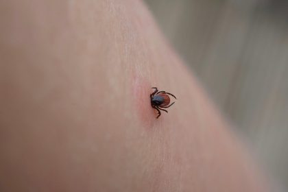 Nebezpecny moze byt aj obycajny obed Uhryznutie kliestom moze sposobit smrtelnu alergiu na maso