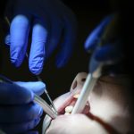 Ziadne korunky ani implantaty Vedci chcu prinutit telo aby si nove zuby vypestovalo samo