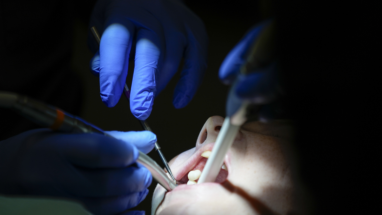 Ziadne korunky ani implantaty Vedci chcu prinutit telo aby si nove zuby vypestovalo samo